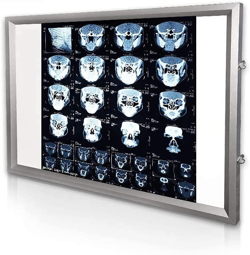 Medical viewing lights.1